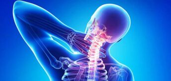 Uzroci cervikalne osteohondroze