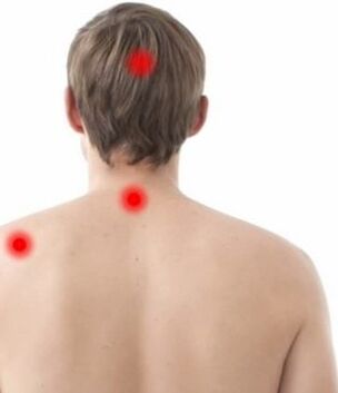 mjesto boli kod cervikalne osteohondroze
